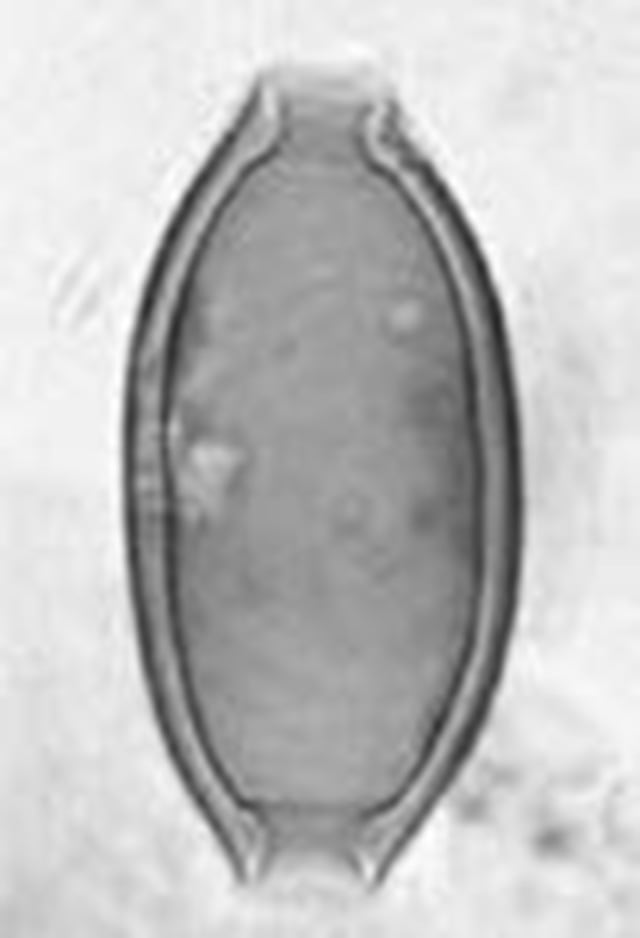 鞭虫の顕微鏡写真（元岡・桑原遺跡群）